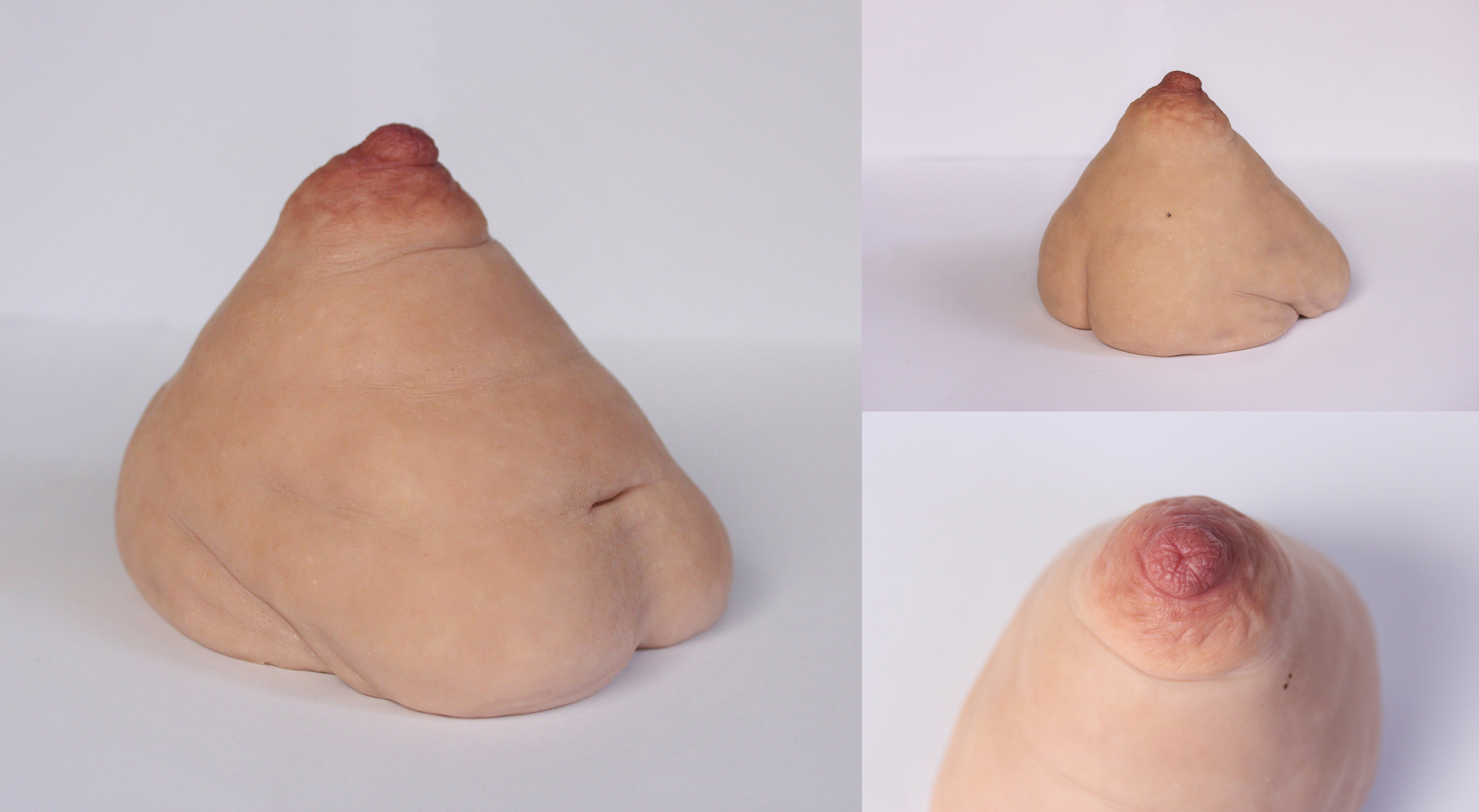 Breast showcase board 1